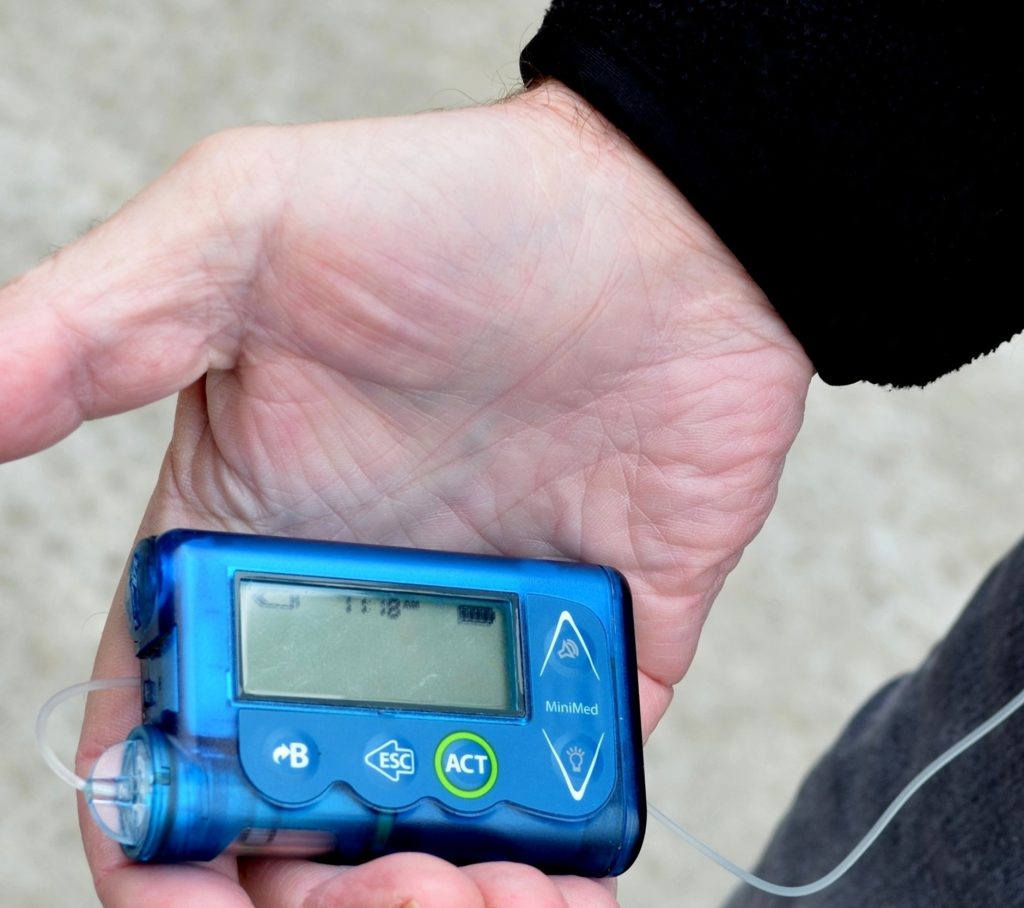 insulin pump picture