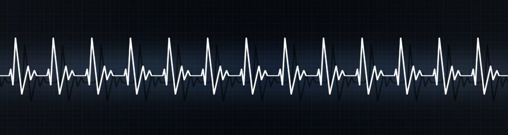 medical banner illustrating rapid heart pulse on ecg. heart rate more than 90 beats per minute. emotioanl stress, physical pressure, heart disease